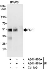 FOP Polyclonal Antibody