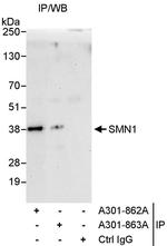 SMN1 Polyclonal Antibody