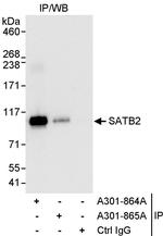 SATB2 Antibody in Immunoprecipitation (IP)