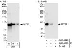 SATB2 Antibody in Western Blot (WB)