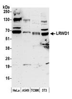 LRWD1 Polyclonal Antibody