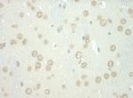 WDFY3 Polyclonal Antibody