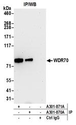 WDR70 Polyclonal Antibody