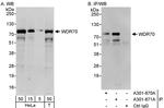 WDR70 Polyclonal Antibody