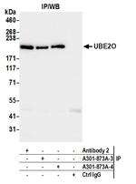 UBE2O Antibody in Immunoprecipitation (IP)