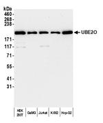 UBE2O Polyclonal Antibody