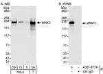 WNK3 Polyclonal Antibody