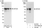 ZNF326 Antibody in Western Blot (WB)
