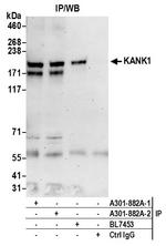 KANK1 Antibody in Immunoprecipitation (IP)