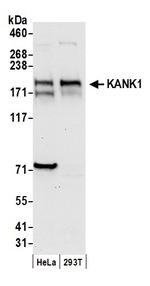 KANK1 Polyclonal Antibody