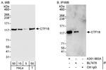 CTF18 Antibody in Western Blot (WB)