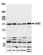 SOS2 Polyclonal Antibody