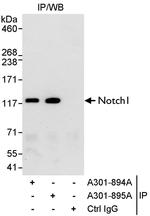 Notch1 Antibody in Immunoprecipitation (IP)