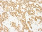 EEA1 Polyclonal Antibody