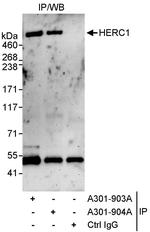 HERC1 Antibody in Immunoprecipitation (IP)