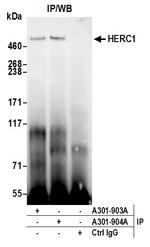 HERC1 Antibody in Immunoprecipitation (IP)
