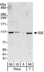 IDE Antibody in Western Blot (WB)