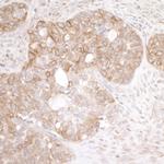 EML4 Antibody in Immunohistochemistry (Paraffin) (IHC (P))