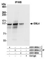 EML4 Antibody in Immunoprecipitation (IP)