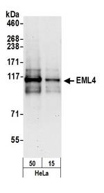 EML4 Antibody in Western Blot (WB)