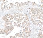 EML4 Polyclonal Antibody