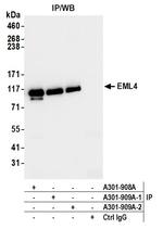 EML4 Antibody in Immunoprecipitation (IP)