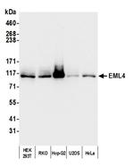 EML4 Antibody in Western Blot (WB)