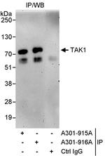 TAK1 Polyclonal Antibody