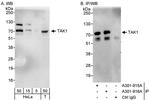 TAK1 Antibody in Western Blot (WB)