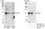 GCF Polyclonal Antibody