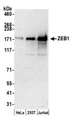 ZEB1 Polyclonal Antibody