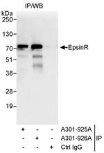 EpsinR Polyclonal Antibody