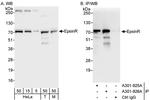 EpsinR Polyclonal Antibody