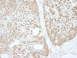 ZBTB40 Polyclonal Antibody
