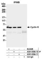 Cyclin K Antibody in Immunoprecipitation (IP)