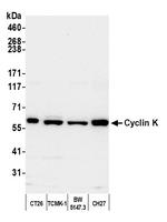 Cyclin K Antibody in Western Blot (WB)