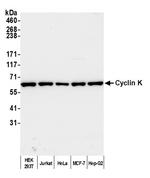 Cyclin K Antibody in Western Blot (WB)