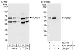 PLRG1 Antibody in Western Blot (WB)