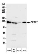 CEP97 Antibody in Western Blot (WB)