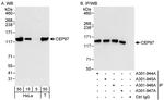 CEP97 Antibody in Western Blot (WB)