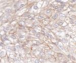 IQGAP1 Polyclonal Antibody
