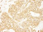 PDZ-RhoGEF Antibody in Immunohistochemistry (Paraffin) (IHC (P))