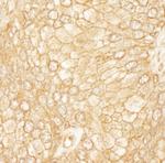 PDZ-RhoGEF Polyclonal Antibody