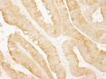 vPARP Antibody in Immunohistochemistry (Paraffin) (IHC (P))
