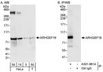 ARHGEF16 Antibody in Western Blot (WB)