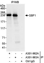 GBF1 Polyclonal Antibody