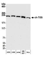 ch-TOG Polyclonal Antibody