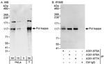Pol kappa Polyclonal Antibody