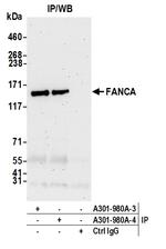 FANCA Antibody in Immunoprecipitation (IP)