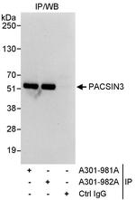 PACSIN3 Antibody in Immunoprecipitation (IP)